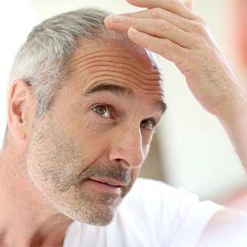 Czy tylko mężczyźni dziedziczą łysienie?