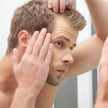 Łysienie androgenowe – sprawdź, jak można je pokonać